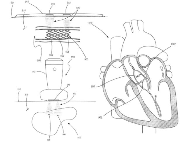 xenter ultrasonic sensor